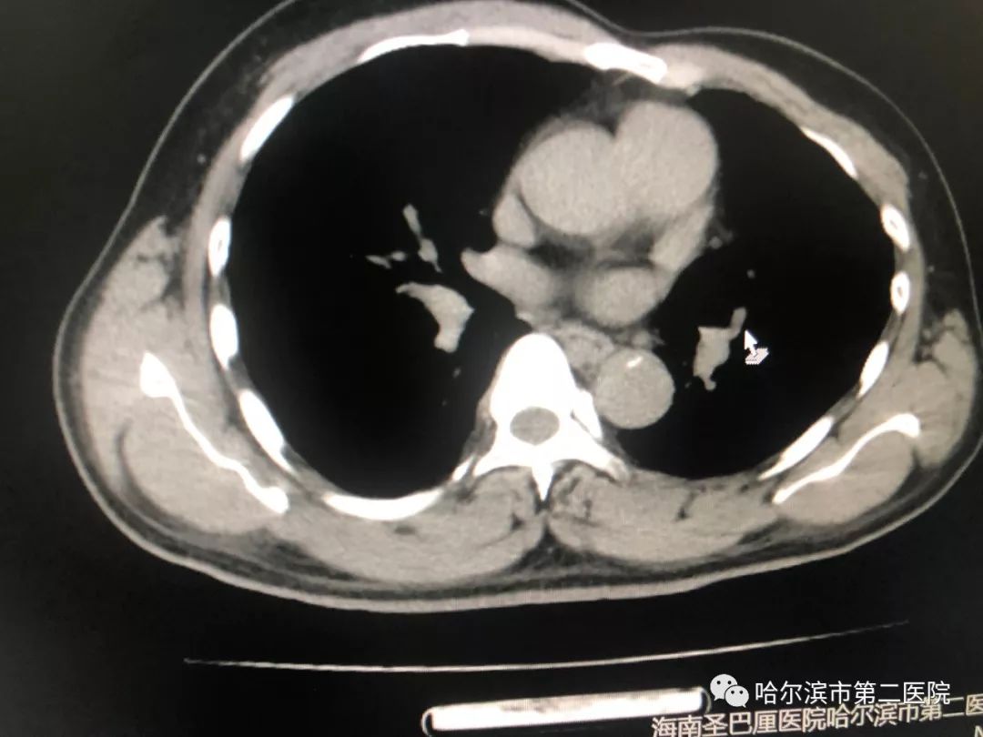 【诊室】 精准诊断 无缝对接 致命的胸痛不致