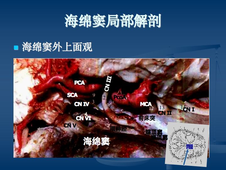 神经解剖:脑血管之动脉系和静脉系(全227页)