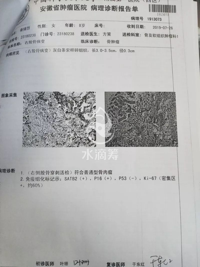 可怜岳西一小姑娘年仅8岁身患骨肉瘤