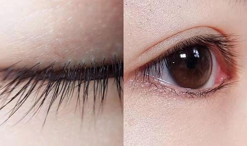 开眼角对眼睛有伤吗 75ea138c64a144a990634cf0cdc7e720.jpeg