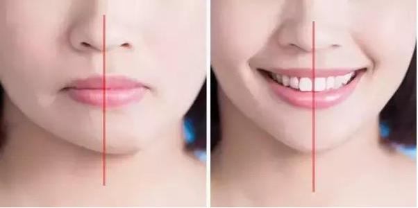                     原创            女儿熟睡时，被妈妈用胶带封嘴，医生直竖大拇指：机智宝妈