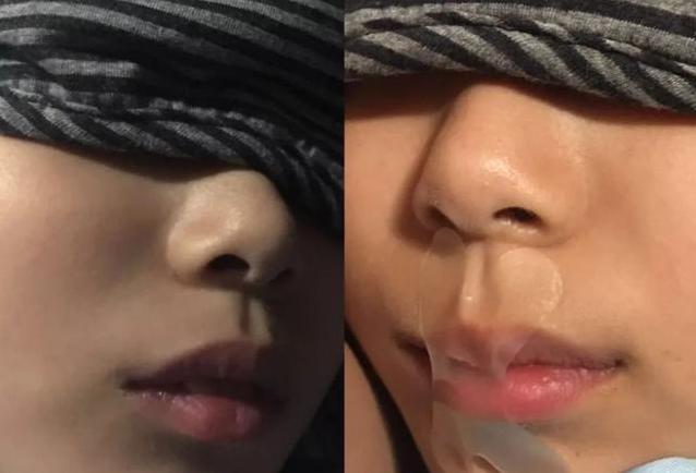                     原创            女儿熟睡时，被妈妈用胶带封嘴，医生直竖大拇指：机智宝妈