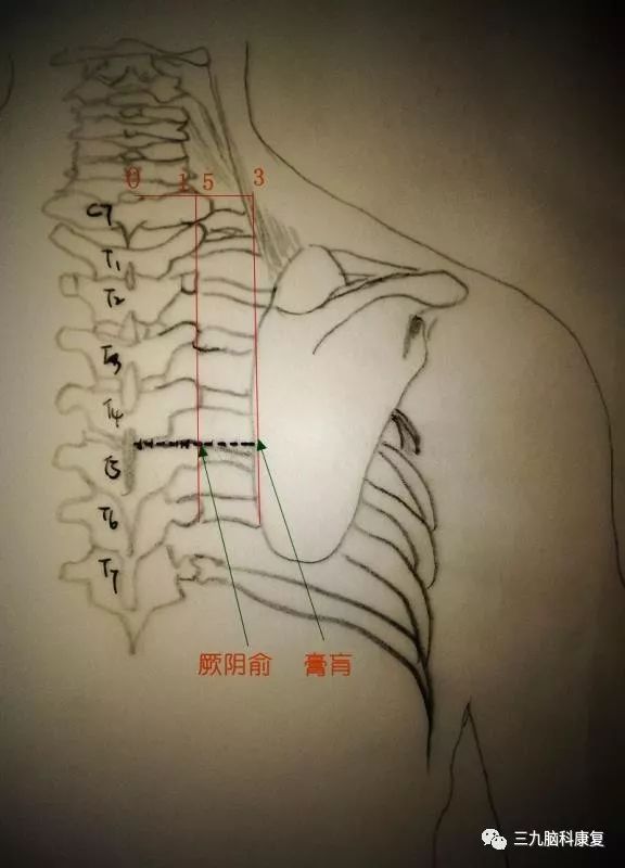 经穴古今谈病入膏肓与膏肓穴