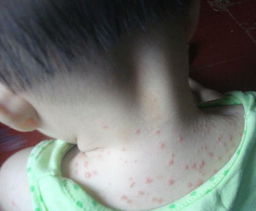                     立秋后怎么养娃不生病？宝妈提前注意这4点，给宝宝更多抵抗力