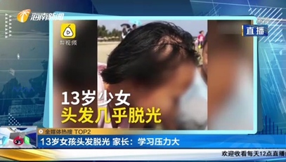                     13岁女孩头发已脱光，连眉毛睫毛都没了，家长：学习压力大