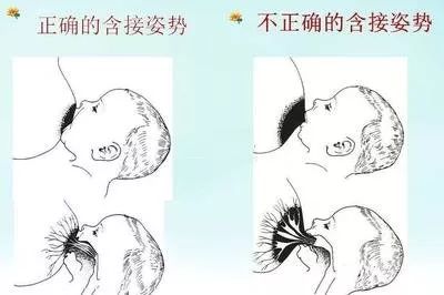 2  早吸吮 出生1小时内,让宝宝吸吮妈妈的乳头.