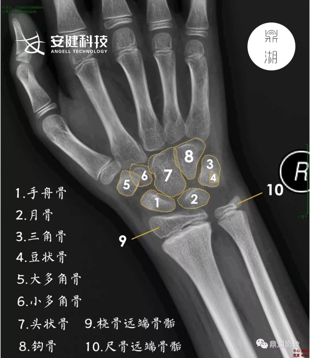 图4-41 腕关节运动轴-手外科解剖学图鉴-医学