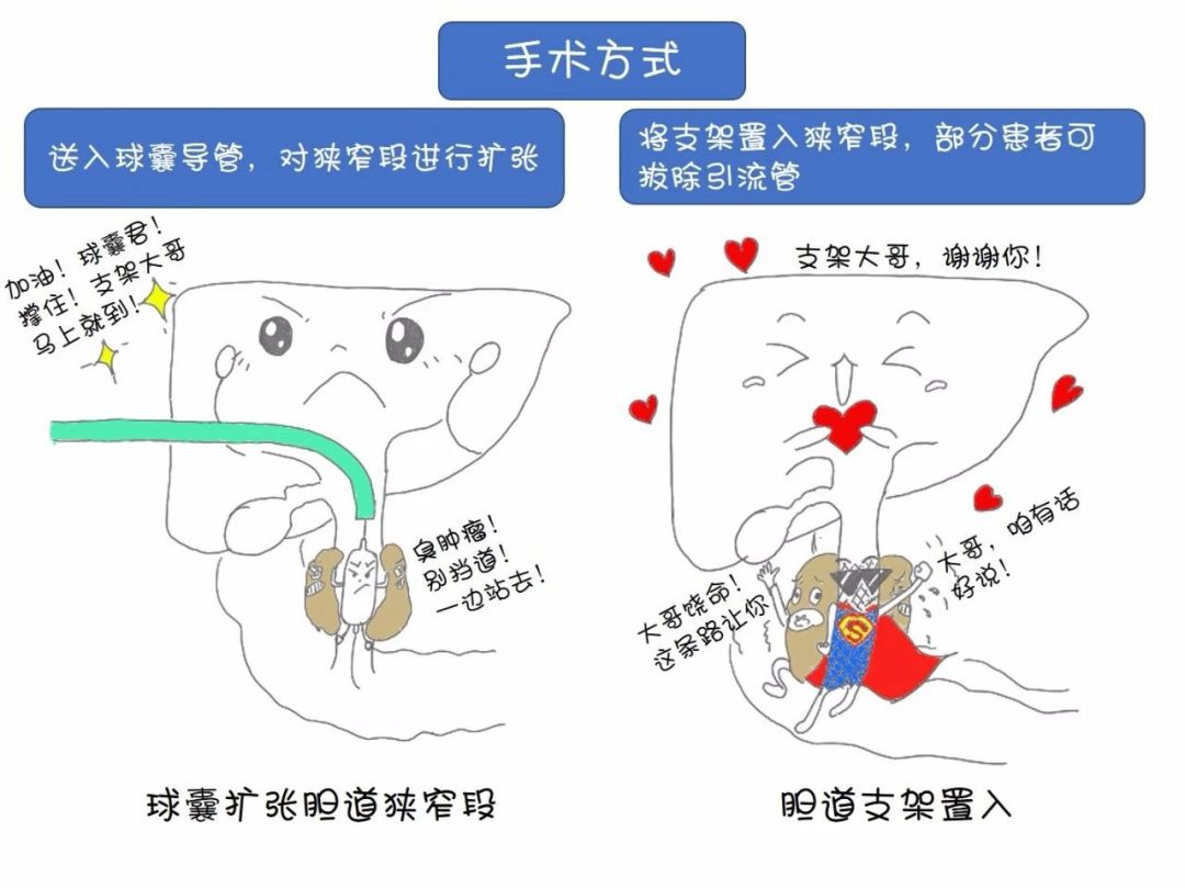 七旬萌大爷变成小黄人竟是因为这个病神奇的ptcd