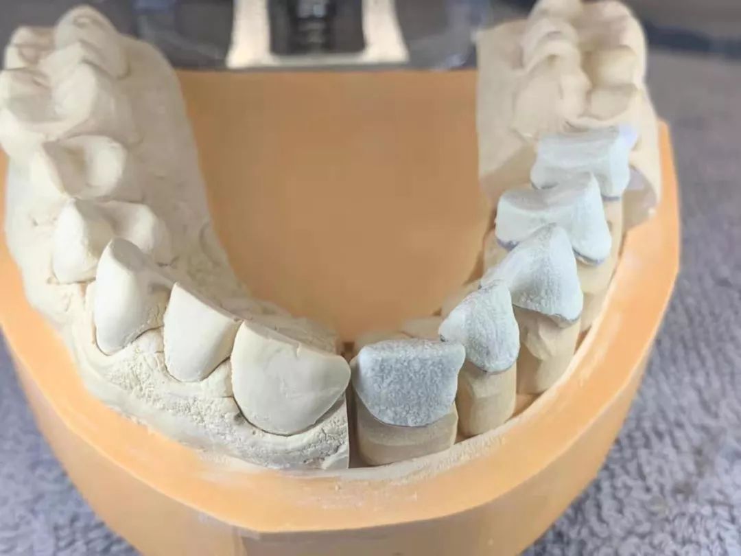 单颗牙齿模型图片,单个牙齿图片大全,牙齿模型图片(第10页)_大山谷图库