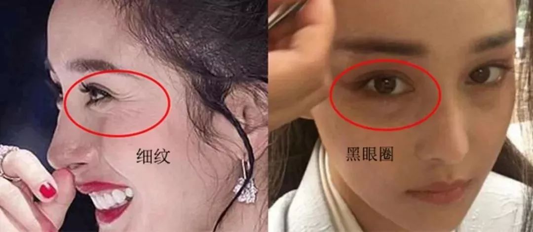 大部分的细纹都是从不管不顾的干纹发展起来的!
