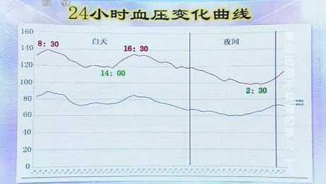 原创哪些情况可以停降压药?搞清关于高血压8个问题,血压平稳有保障