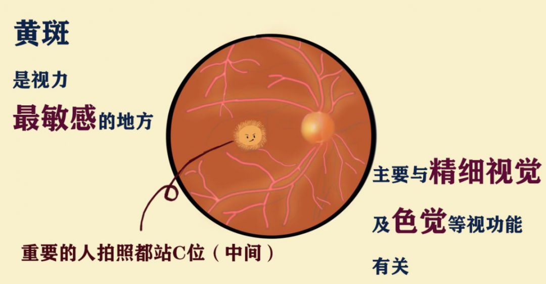 干眼症?也许是眼底黄斑病变!