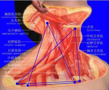 (颈侧方深层肌三角区三针法定位)