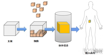 糖尿病的人透析是什么原理_什么是糖尿病图片(2)