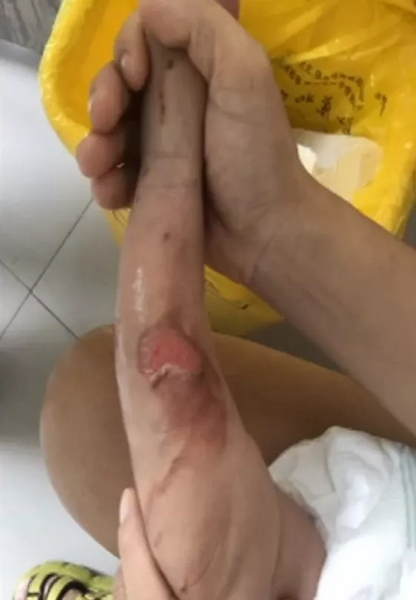                     月嫂抱着40天男婴做饭，鸡蛋突然爆开
