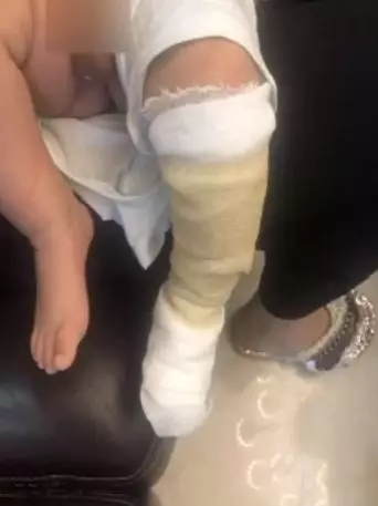                     月嫂抱着40天男婴做饭，鸡蛋突然爆开