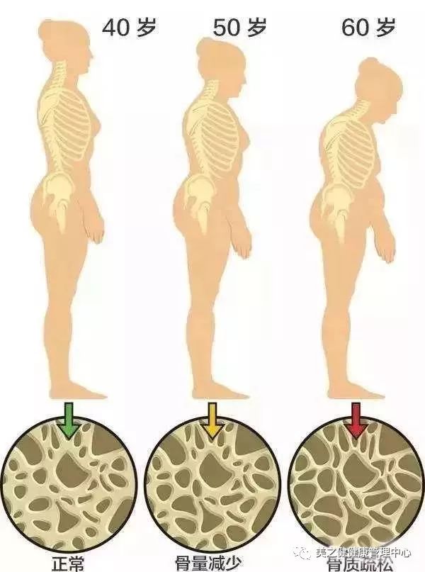 咋样减少老年斑 a69c01d48a4546e08a847d2162889d3f.jpeg