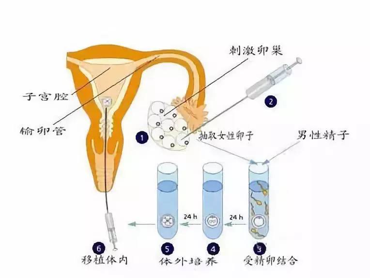 为什么别人我年龄大,还能取出很多卵子