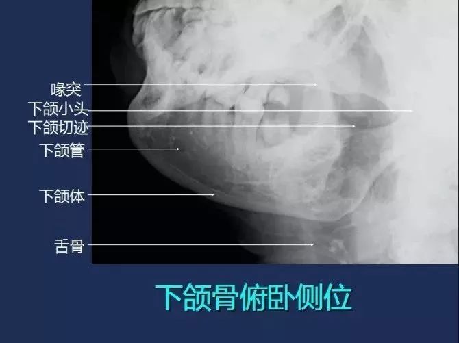 史上最全常规x线影像解剖大全建议收藏