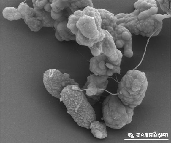 收藏56张图片带您认识细菌长啥样