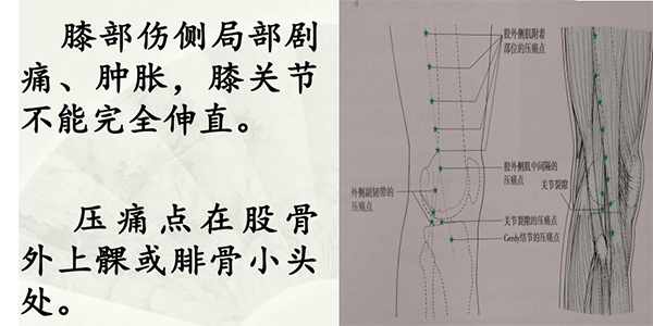 膝关节痛的内热针治疗