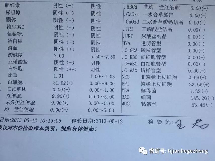 招飞体检之尿常规各项指标解读上