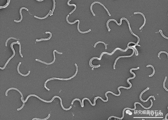 收藏56张图片带您认识细菌长啥样