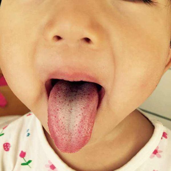                     原创            如何判断宝宝积食？观察他有没有这3种症状，占一种都不可小瞧