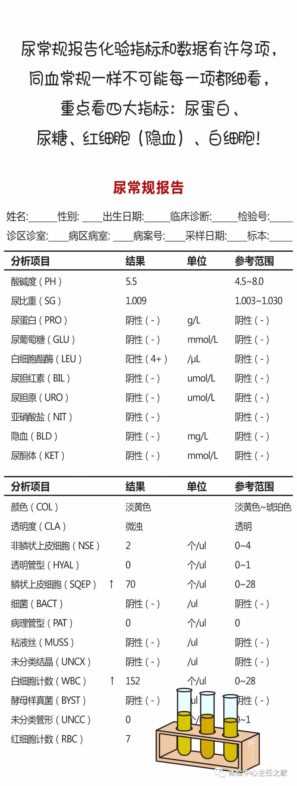 它不仅能反映泌尿系统的问题,还可以间接反映肾病,糖尿病,肝胆疾病等