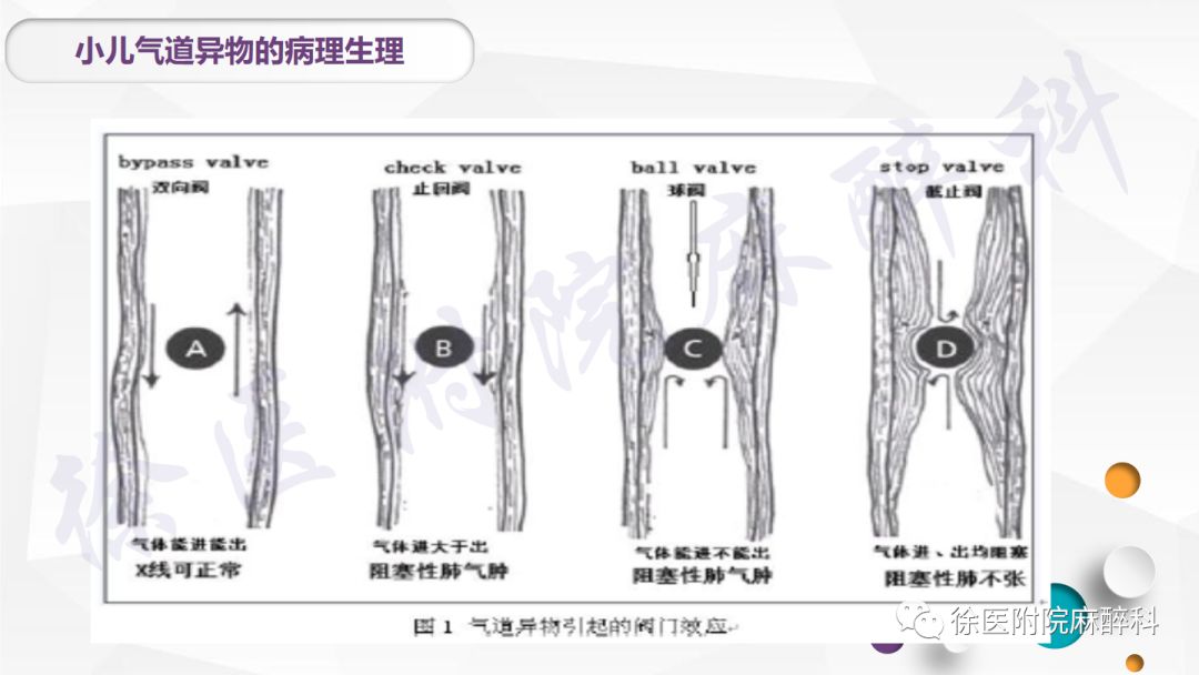 耳后止痛贴是什么原理_钱是万能止痛贴图片(3)