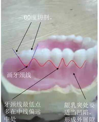 五)画牙根线