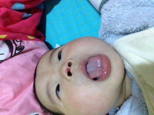                     4岁娃刚上幼儿园，却因口臭被同学孤立，检查后，护士差点没忍住
