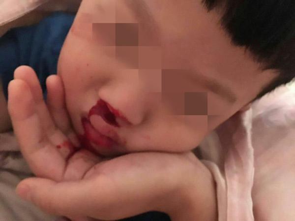                     4岁娃刚上幼儿园，却因口臭被同学孤立，检查后，护士差点没忍住