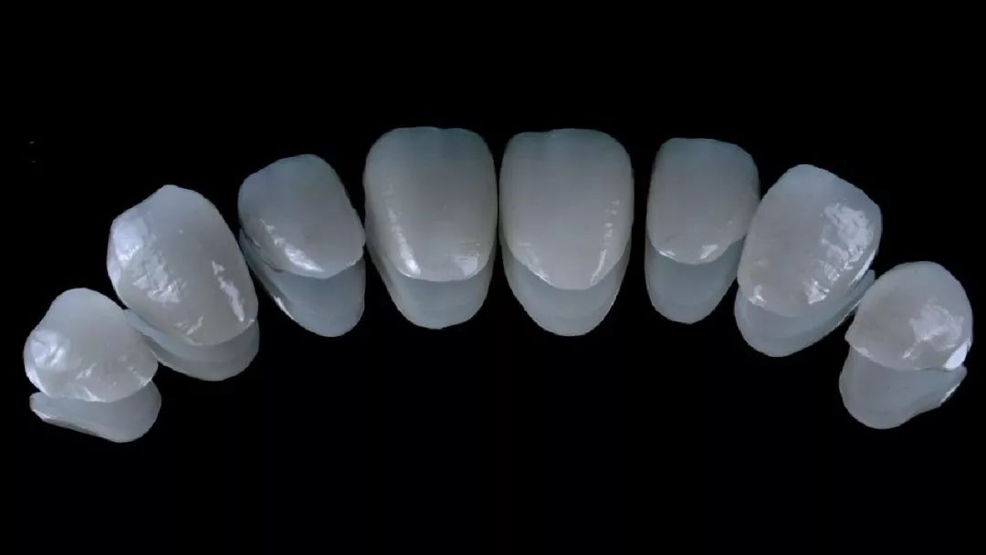 在前牙的美学修复治疗中,要根据每个患者的不同口腔条件,来选择适合