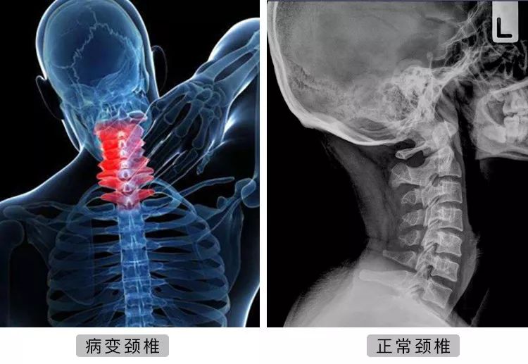 神经源性损害看什么科 cfe3c99341c8497380aa608f41afa03d.jpeg