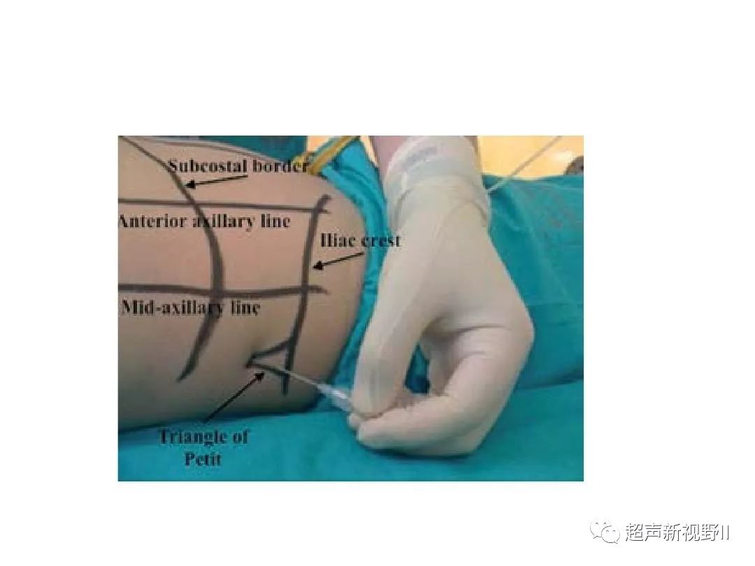 精彩课件 | 超声引导腰方肌阻滞