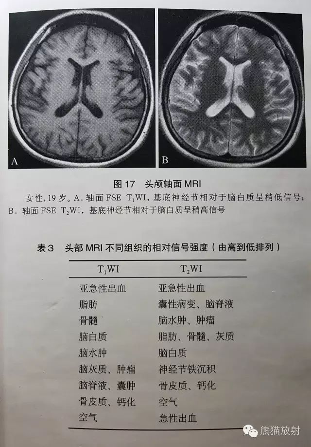 【mri小问】如何分辨t1wi与t2wi?