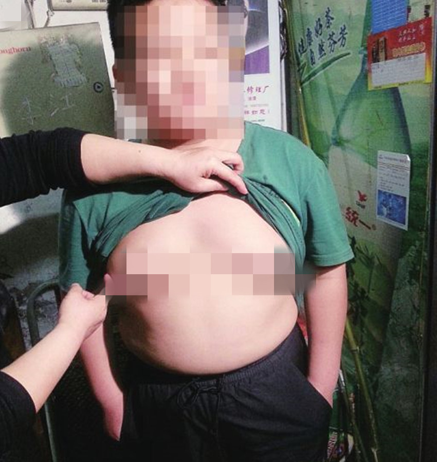                     九岁男孩遇到这个性别不该有的尴尬，罪魁祸首只因“它”，要重视