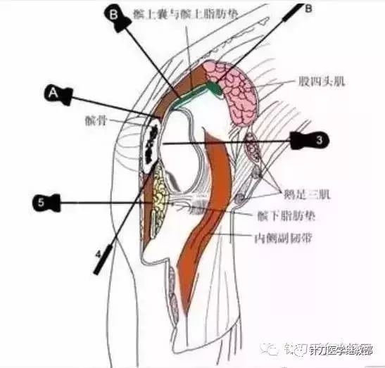 操作①执行手法操作的条件一是针刀闭合型手术对膝关节周围的粘连