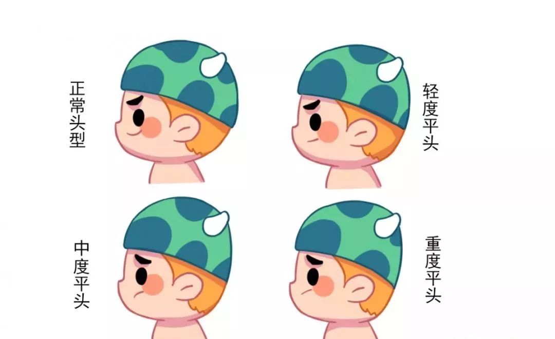                     头型会影响智力发育？孩子睡扁头好还是圆头好？