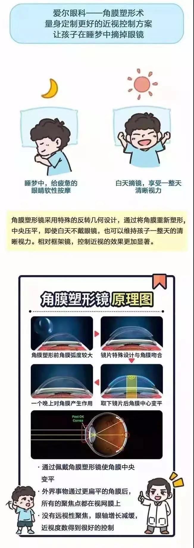 3,角膜塑形镜效果怎么样?角膜塑