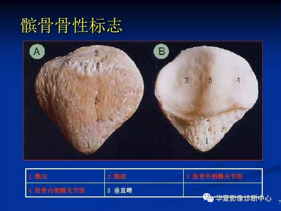 超全丨膝关节解剖基础