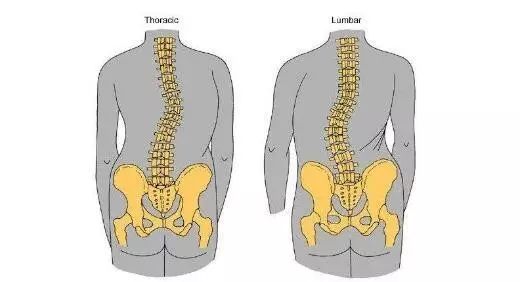 功能性脊柱侧弯是指: 骨骼正常 如果你是属于这三种 那么很有