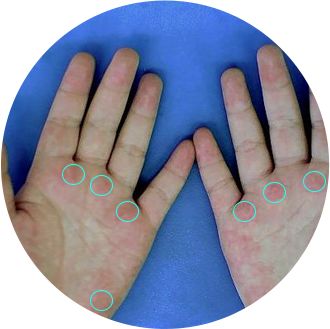 “刷脸”就能晨检的校园黑科技,阿童目晨检机器人实现AI童脸识别