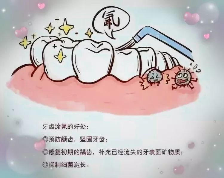 父母定期查看小儿牙齿,刚发现龋齿时就及时充填补牙,防止龋洞变深变大