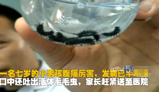                     原创            7岁苗族男童腹痛狂吐毛毛虫 父母怀疑其被人下蛊