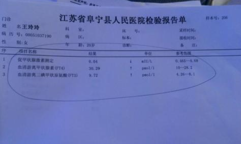                     怀孕期间甲亢指标偏高怎么回事？小心点宝宝的智力？不需太过慌张