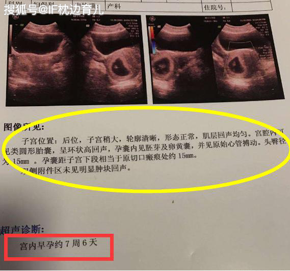 原创怀孕多久能测出来?有的21天就发现了,有的三个多月才知道