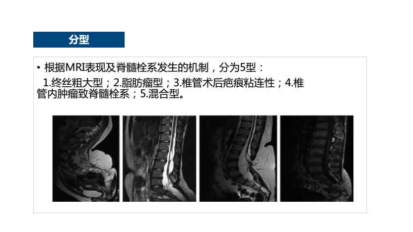 读书报告会六十内容脊髓栓系综合征患者椎管内麻醉致神经损伤一例