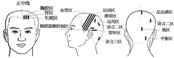 针灸按摩全息之精髓全身投影图